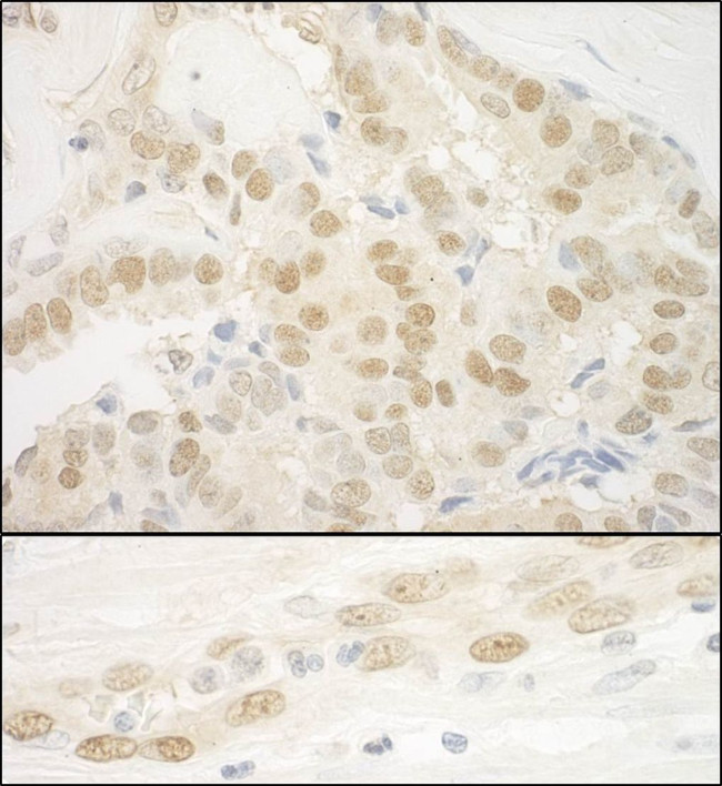 MKL2 Antibody in Immunohistochemistry (IHC)