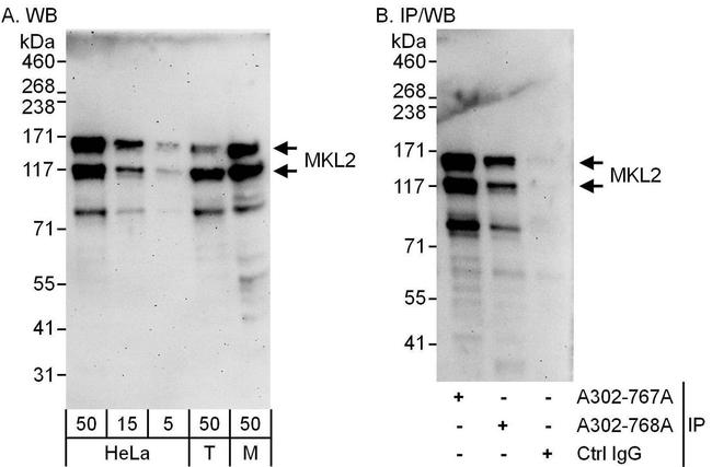 MKL2 Antibody in Western Blot (WB)