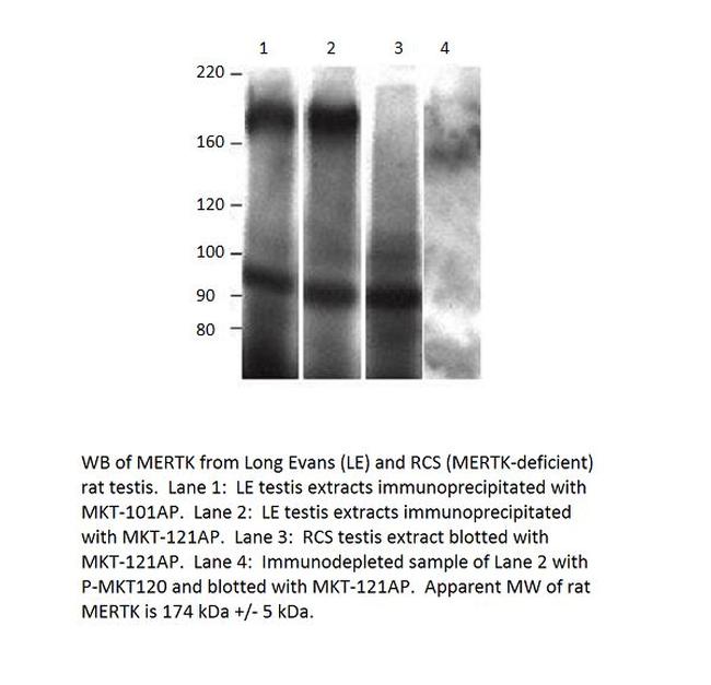 MERTK Antibody in Western Blot (WB)