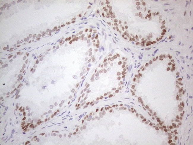 MKX Antibody in Immunohistochemistry (Paraffin) (IHC (P))