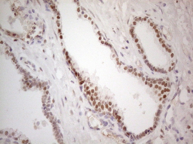 MKX Antibody in Immunohistochemistry (Paraffin) (IHC (P))