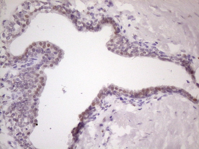 MKX Antibody in Immunohistochemistry (Paraffin) (IHC (P))