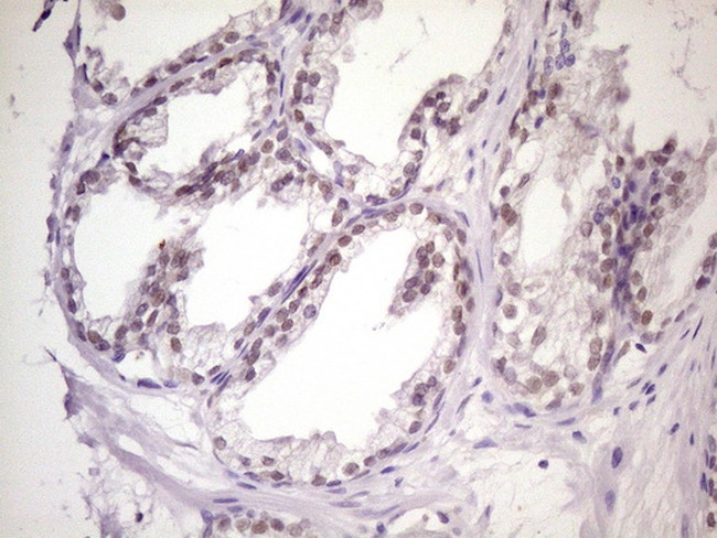 MKX Antibody in Immunohistochemistry (Paraffin) (IHC (P))