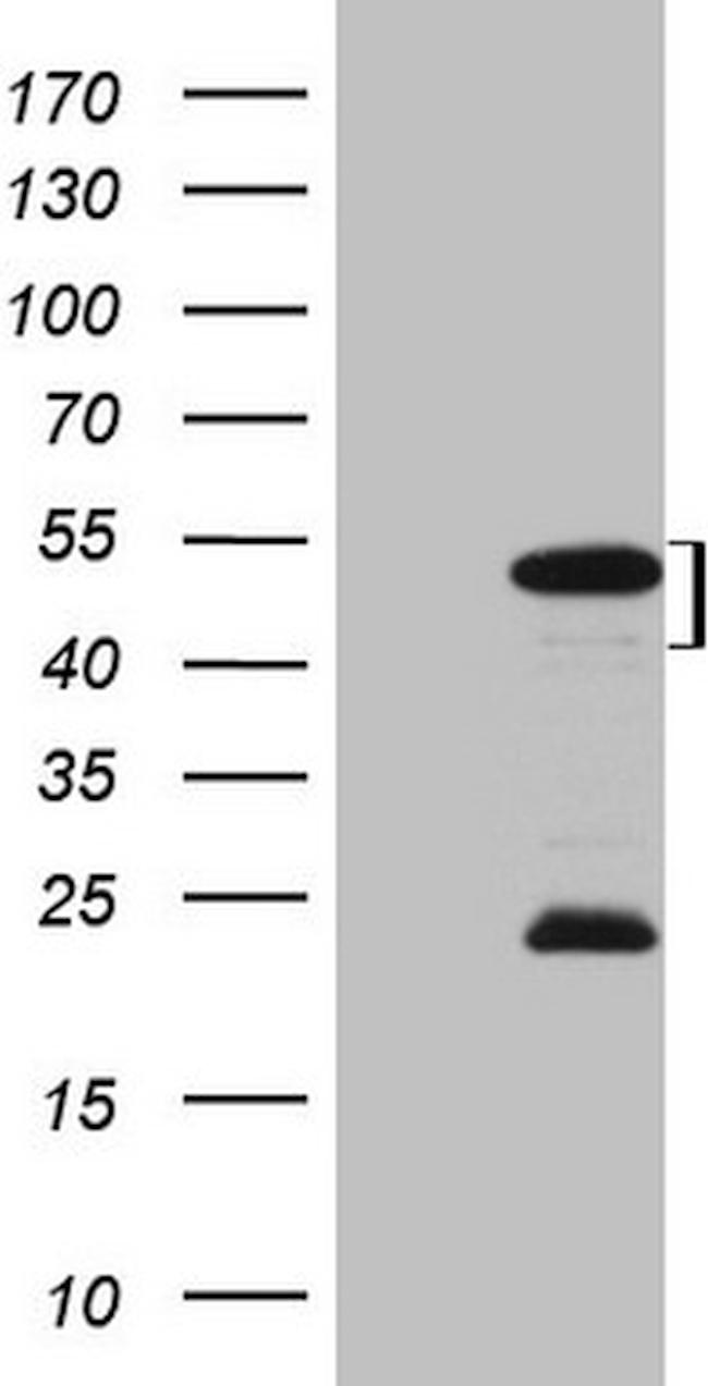 MKX Antibody in Western Blot (WB)