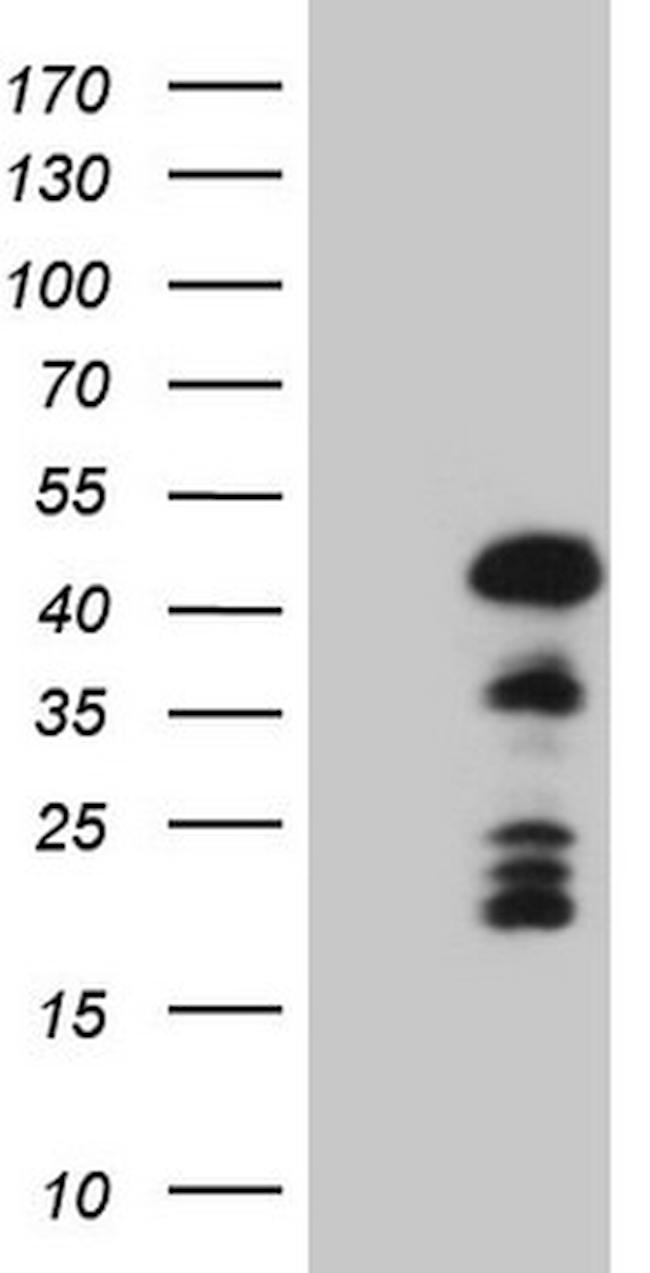 MKX Antibody in Western Blot (WB)