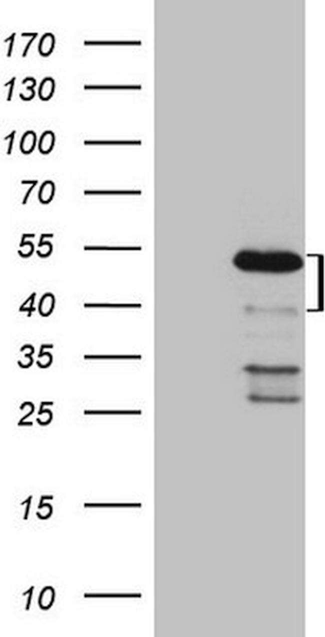 MKX Antibody in Western Blot (WB)