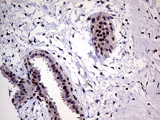 MLH1 Antibody in Immunohistochemistry (Paraffin) (IHC (P))