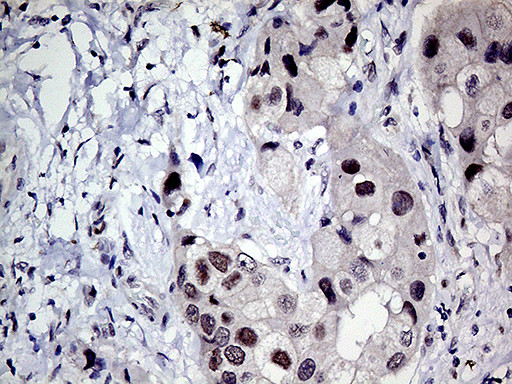 MLH1 Antibody in Immunohistochemistry (Paraffin) (IHC (P))