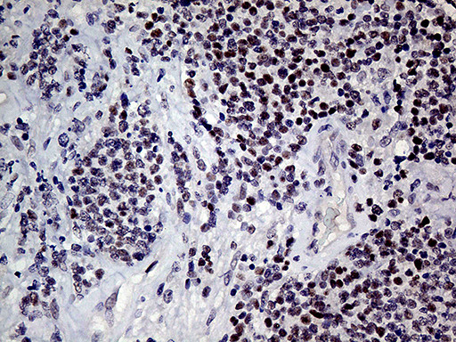 MLH1 Antibody in Immunohistochemistry (Paraffin) (IHC (P))