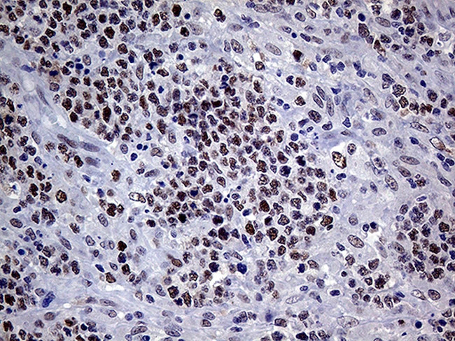 MLH1 Antibody in Immunohistochemistry (Paraffin) (IHC (P))