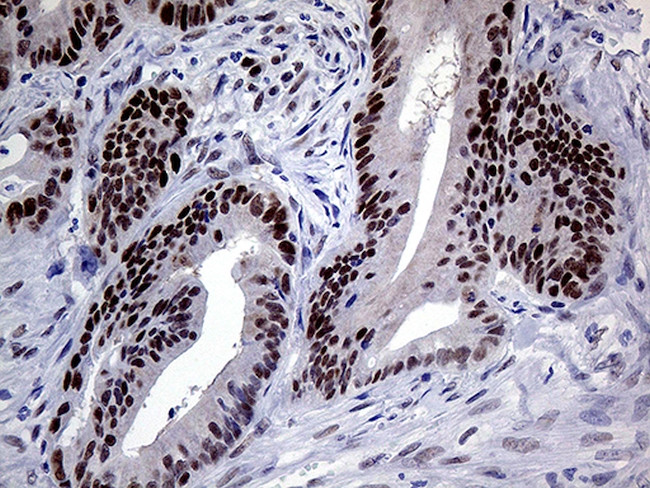 MLH1 Antibody in Immunohistochemistry (Paraffin) (IHC (P))