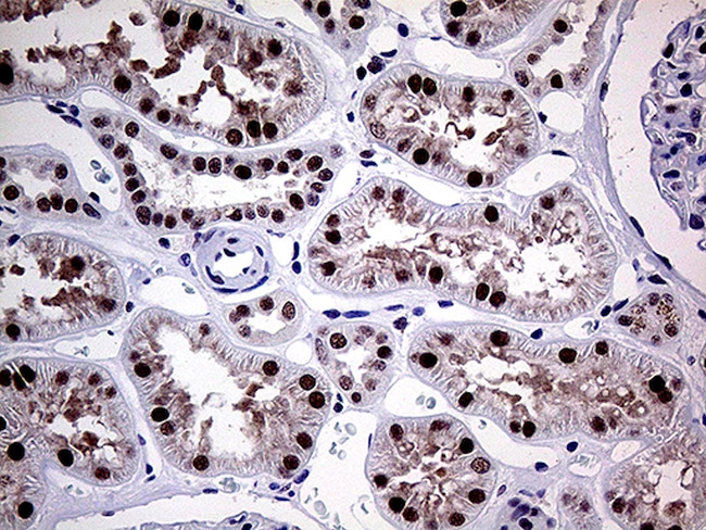 MLH1 Antibody in Immunohistochemistry (Paraffin) (IHC (P))