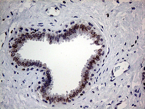 MLH1 Antibody in Immunohistochemistry (Paraffin) (IHC (P))