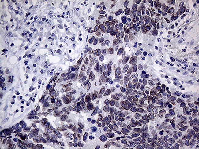 MLH1 Antibody in Immunohistochemistry (Paraffin) (IHC (P))