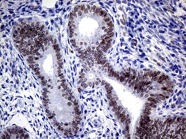 MLH1 Antibody in Immunohistochemistry (Paraffin) (IHC (P))