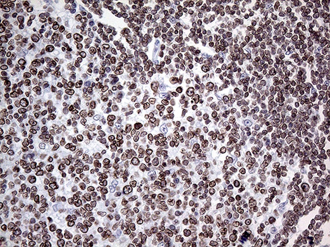 MLH1 Antibody in Immunohistochemistry (Paraffin) (IHC (P))