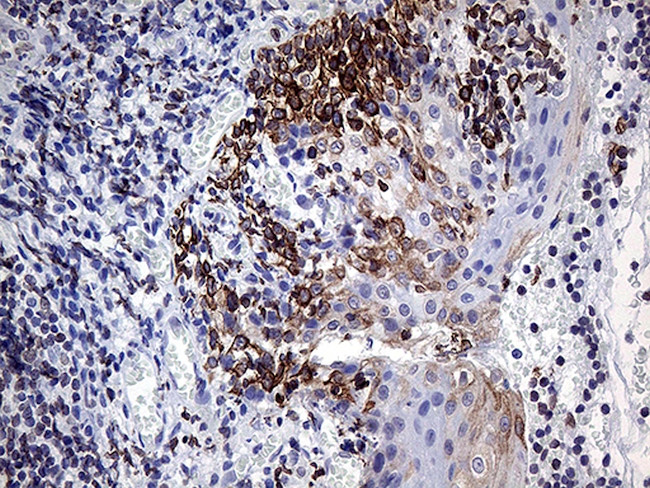 MLH1 Antibody in Immunohistochemistry (Paraffin) (IHC (P))