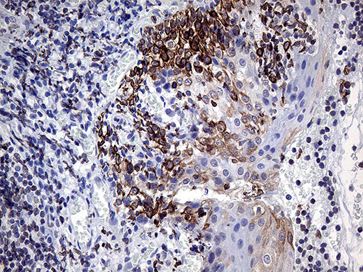 MLH1 Antibody in Immunohistochemistry (Paraffin) (IHC (P))