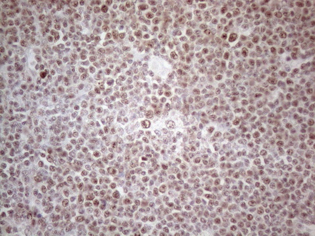 MLH1 Antibody in Immunohistochemistry (Paraffin) (IHC (P))