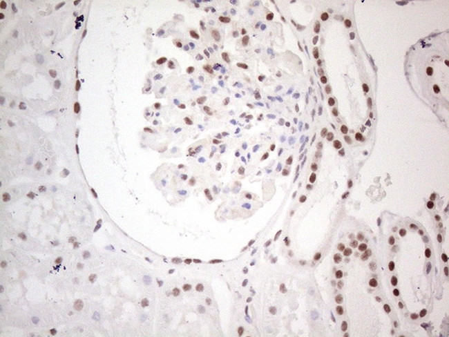 MLH1 Antibody in Immunohistochemistry (Paraffin) (IHC (P))