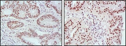 MLH1 Antibody in Immunohistochemistry (Paraffin) (IHC (P))