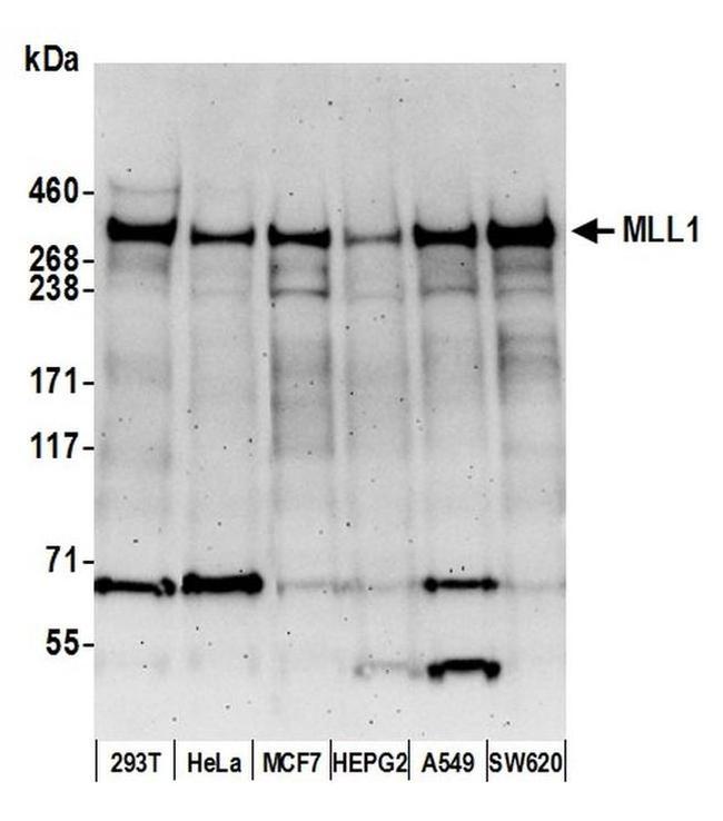 MLL1 Antibody in Western Blot (WB)