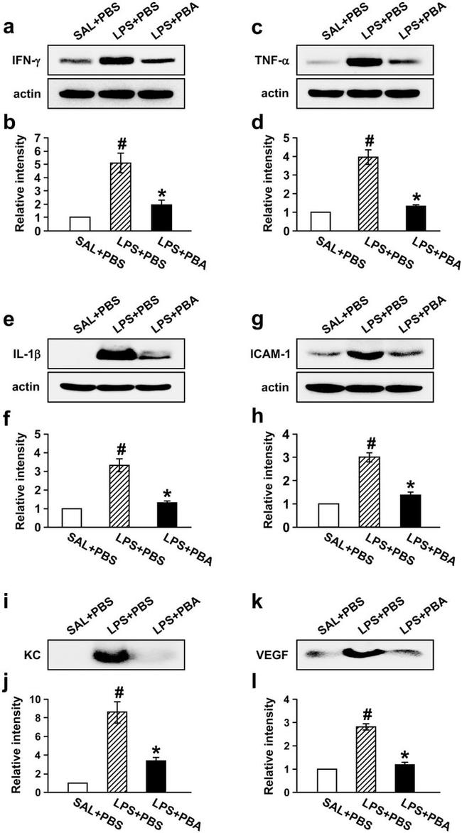 IL-1 beta Antibody in Western Blot (WB)