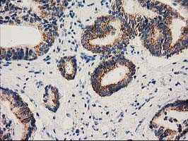 MMAB Antibody in Immunohistochemistry (Paraffin) (IHC (P))