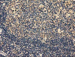 MMAB Antibody in Immunohistochemistry (Paraffin) (IHC (P))