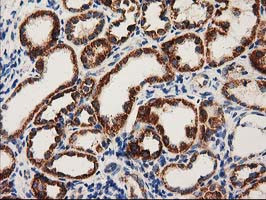 MMAB Antibody in Immunohistochemistry (Paraffin) (IHC (P))