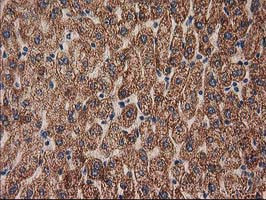 MMAB Antibody in Immunohistochemistry (Paraffin) (IHC (P))