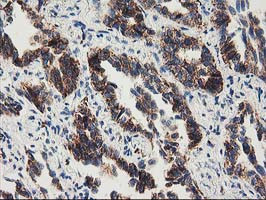 MMAB Antibody in Immunohistochemistry (Paraffin) (IHC (P))