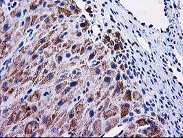 MMAB Antibody in Immunohistochemistry (Paraffin) (IHC (P))