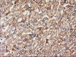 MMAB Antibody in Immunohistochemistry (Paraffin) (IHC (P))