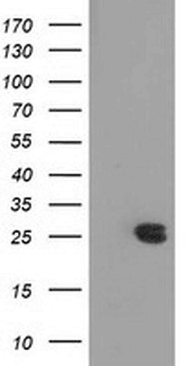 MMAB Antibody in Western Blot (WB)