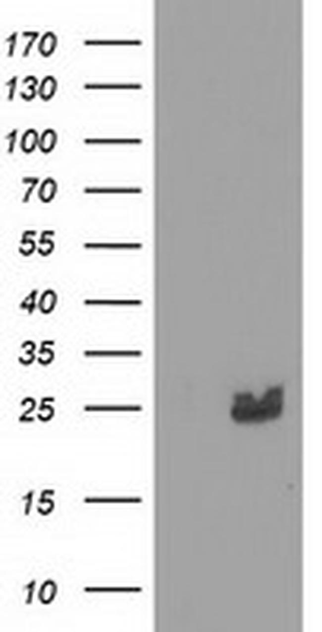 MMAB Antibody in Western Blot (WB)