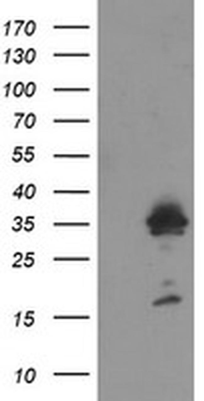 MMACHC Antibody in Western Blot (WB)