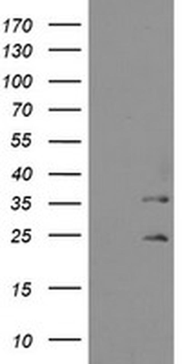 MMACHC Antibody in Western Blot (WB)