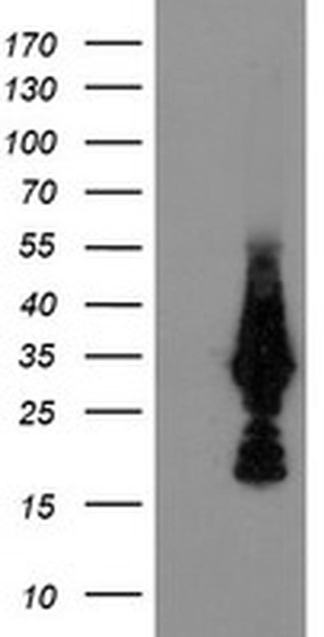 MMACHC Antibody in Western Blot (WB)