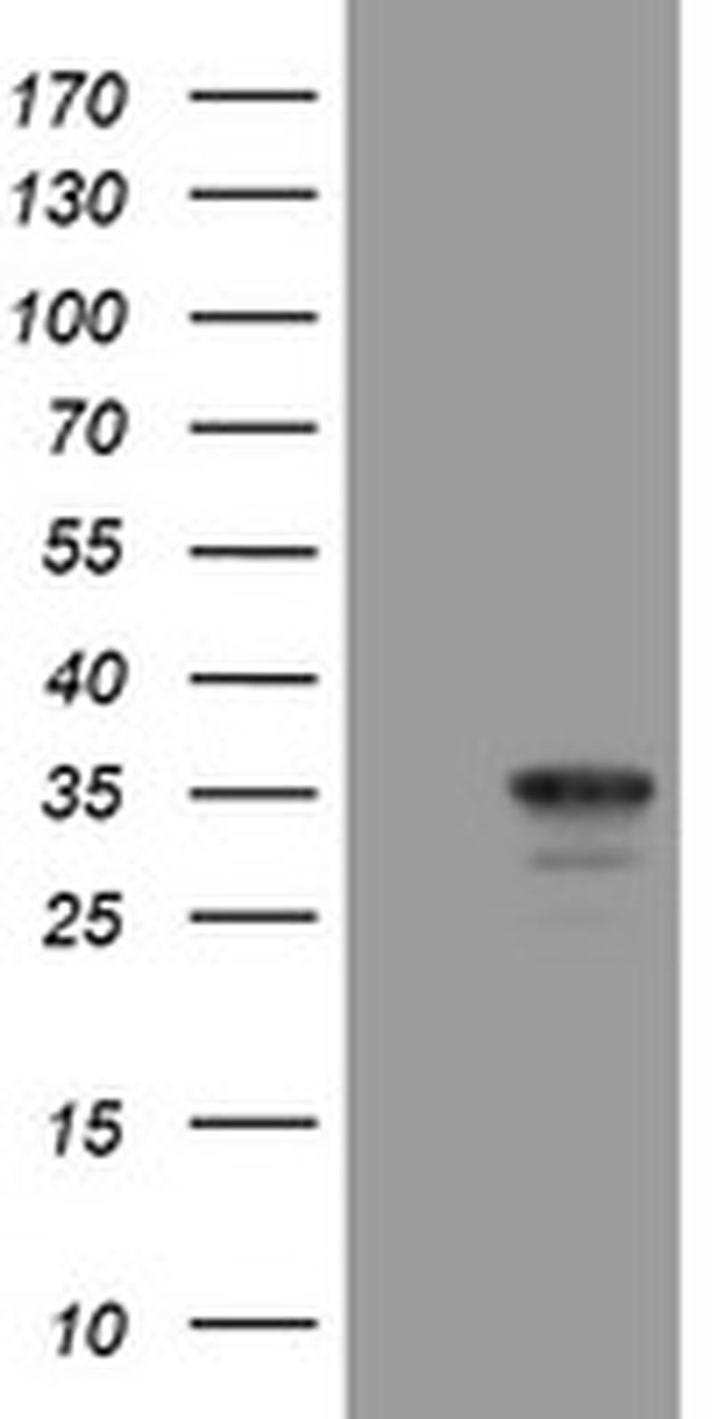 MMACHC Antibody in Western Blot (WB)