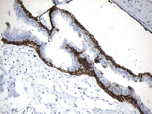 MME Antibody in Immunohistochemistry (Paraffin) (IHC (P))