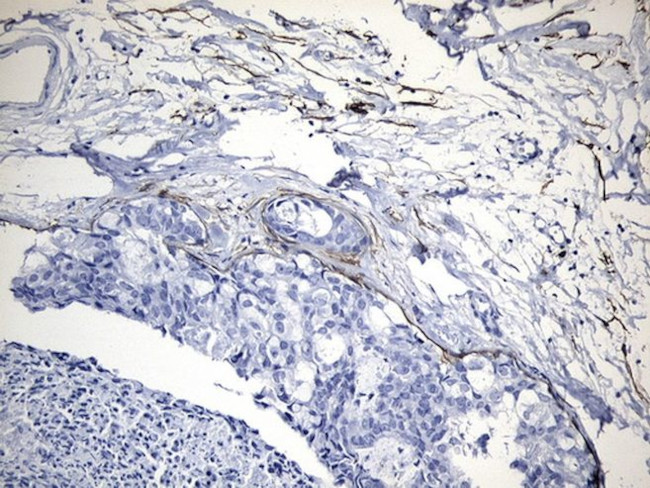 MME Antibody in Immunohistochemistry (Paraffin) (IHC (P))