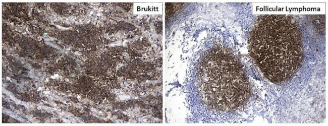 MME Antibody in Immunohistochemistry (Paraffin) (IHC (P))