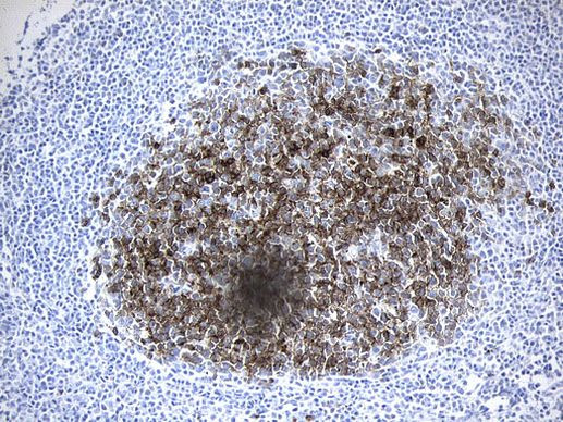 MME Antibody in Immunohistochemistry (Paraffin) (IHC (P))