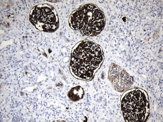 MME Antibody in Immunohistochemistry (Paraffin) (IHC (P))