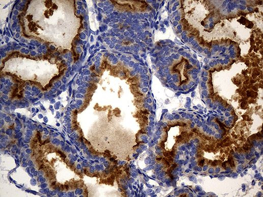 MME Antibody in Immunohistochemistry (Paraffin) (IHC (P))