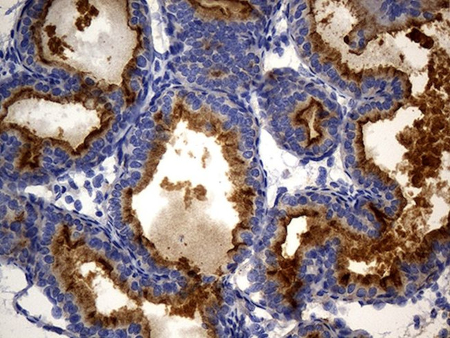 MME Antibody in Immunohistochemistry (Paraffin) (IHC (P))