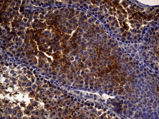 MME Antibody in Immunohistochemistry (Paraffin) (IHC (P))