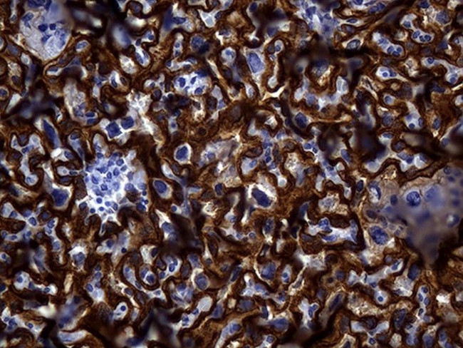 MME Antibody in Immunohistochemistry (Paraffin) (IHC (P))