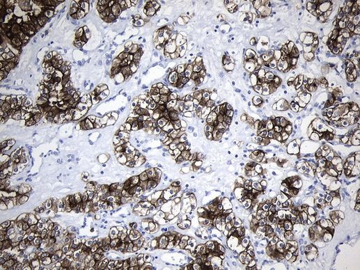 MME Antibody in Immunohistochemistry (Paraffin) (IHC (P))